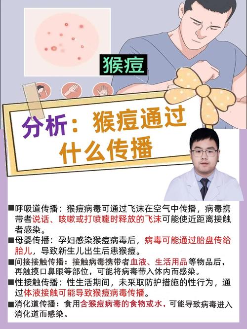 国内猴痘疫情未失控，重点人群加强防控，这些应对要点要知道