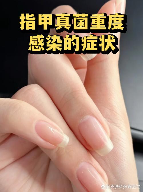 石家庄新增确诊病例详情及感染途径，身体异常要及时就医