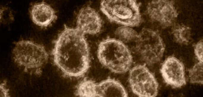 中国最新发现的Langya亨尼帕病毒，症状和传播情况如何？