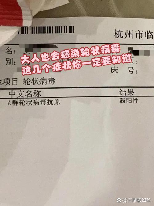 埃博拉病毒最新消息:瑞德西韦作用、宁波疫情防控寻人通告